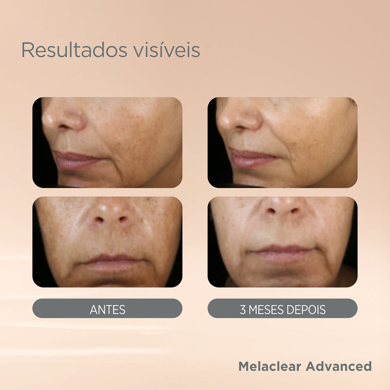 Sérum Facial Clareador Isdin - Melaclear Advanced 30ml